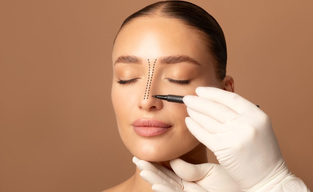 Rhinoplasty,Concept.,Doctor's,Gloved,Hand,Making,Marks,On,Female,Face,