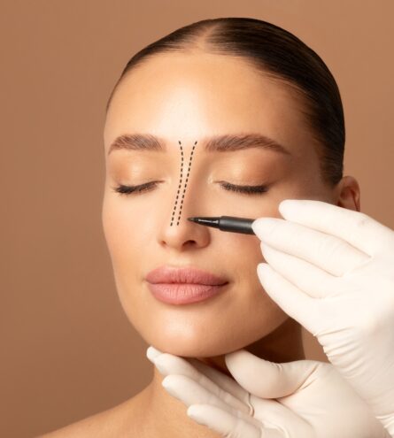 Rhinoplasty,Concept.,Doctor's,Gloved,Hand,Making,Marks,On,Female,Face,