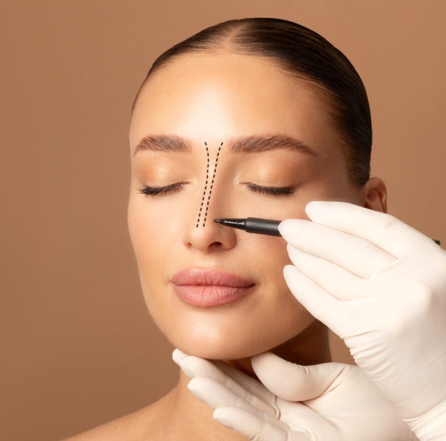 Rhinoplasty,Concept.,Doctor's,Gloved,Hand,Making,Marks,On,Female,Face,