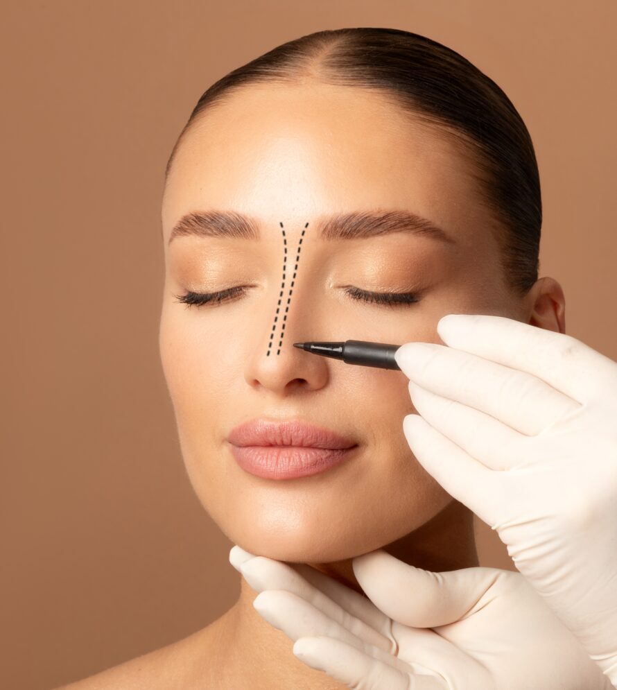 Rhinoplasty,Concept.,Doctor's,Gloved,Hand,Making,Marks,On,Female,Face,