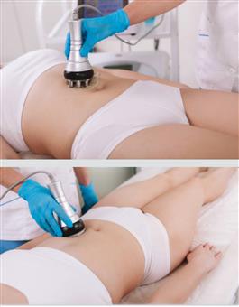 intensivebody
